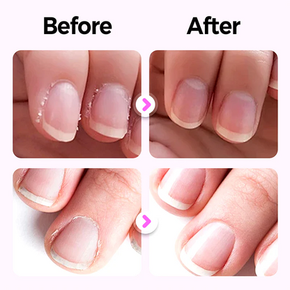3-in-1 Nail Care Pen